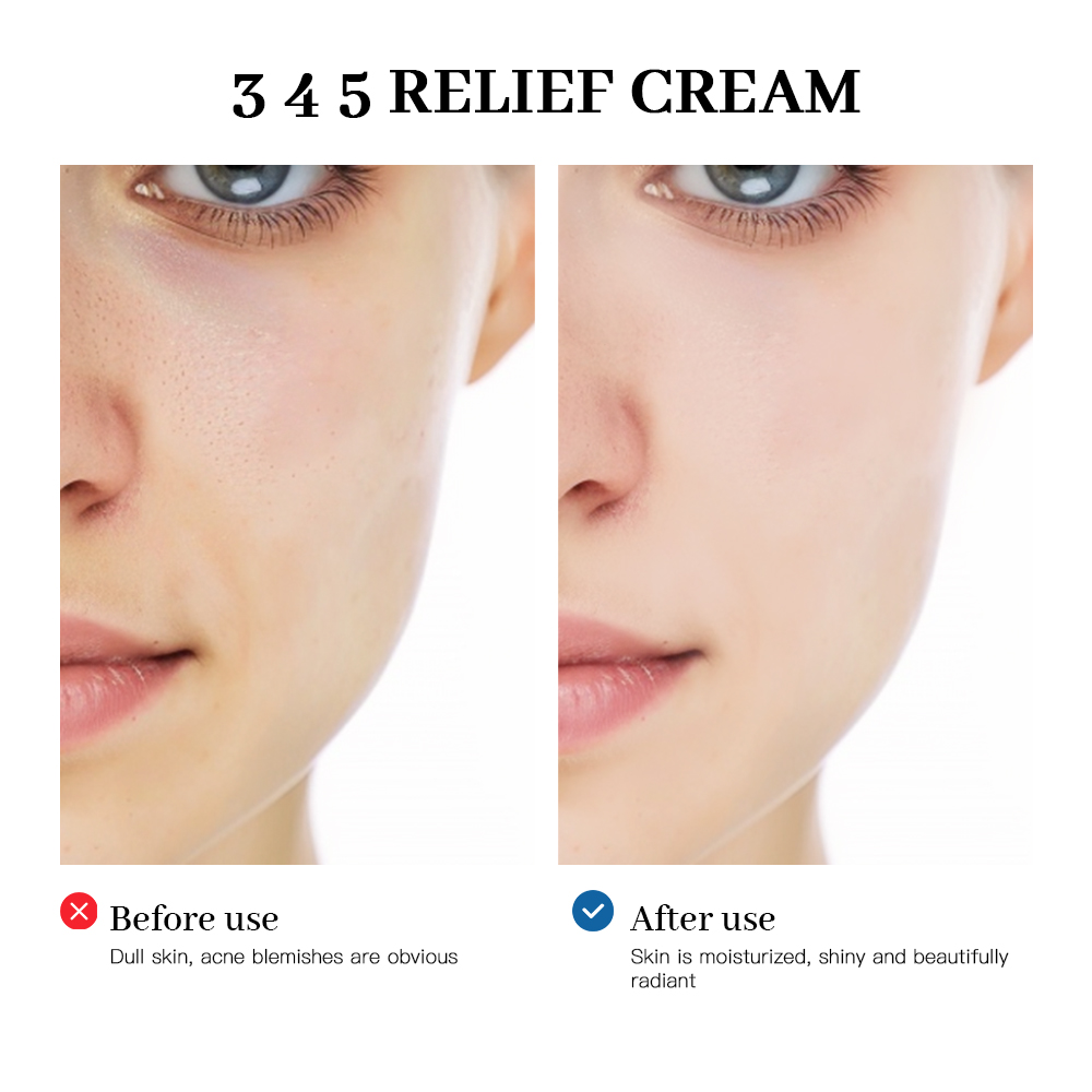345 Rölyef Krem Cilt sorunları - Retinol Cream incelemesi ve fiyatı