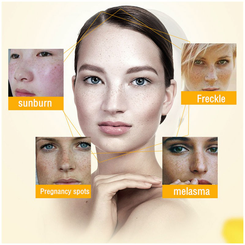 Dimollaure Beyazlatıcı Çil Kre - Retinol Cream incelemesi ve fiyatı