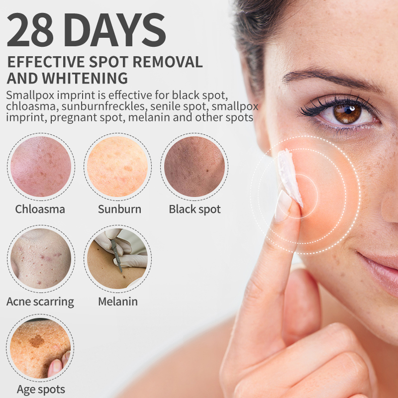 Dimollaure Beyazlatıcı Çil Kre - Retinol Cream incelemesi ve fiyatı